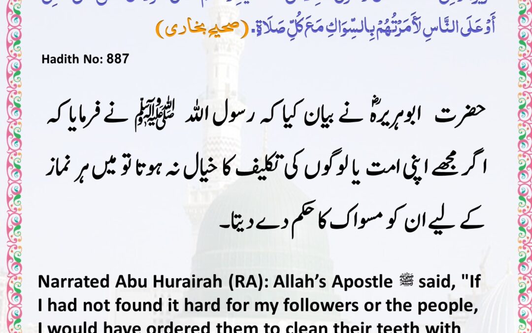 Sahih Bukhari – 887