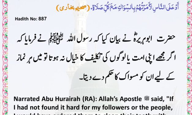 Sahih Bukhari – 887